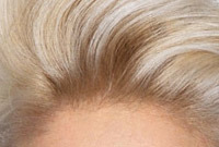 Hair care tips for bleached hair side